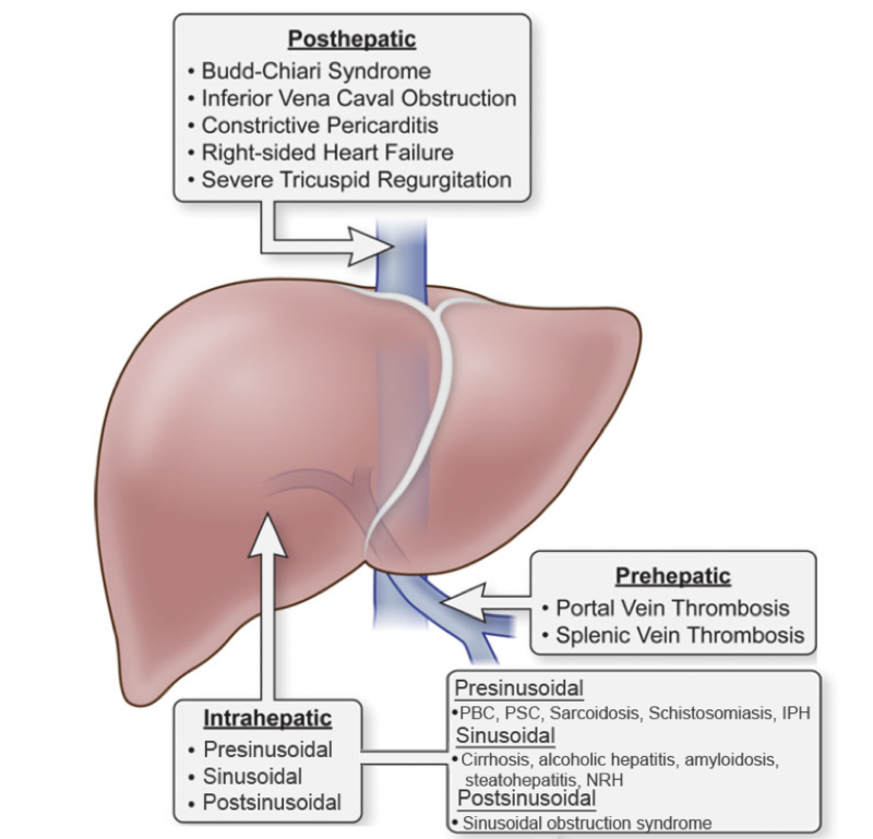 a-puzzling-case-of-portal-hypertension-a-collision-between-hema-and